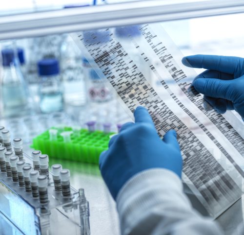 Scientist examining DNA sequencing gel in laboratory